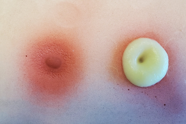 Модель абсцесса (Sim*Abscess) — изображение 3