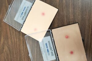 Модель абсцесса (Sim*Abscess)