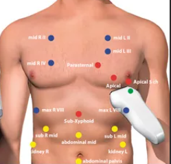 Фантом-система для дефибрилляции AmbuMan Ultrasound Defib Trainer System — изображение 3