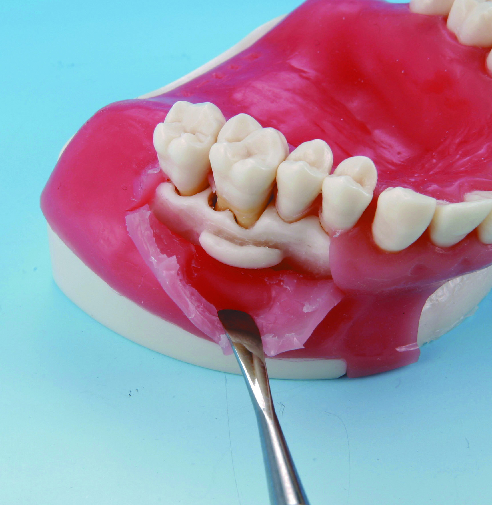 Модель челюсти для хирургии ротовой полости — изображение 6